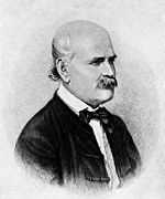 塞麦尔维斯(dr ignaz semmelweis)