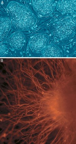 b: nerve cells