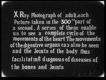 Dr Macintyre's X-Ray Film (1**6)