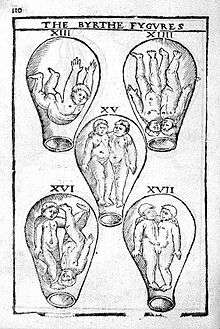 Gravure extraite de The birth of mankinde, otherwise named The womans booke, d'après Eucharius Rösslin, vers 1550.