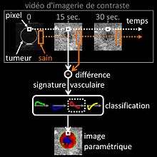 Schéma de principe de l'imagerie par amétrique des signatures vasculaires.