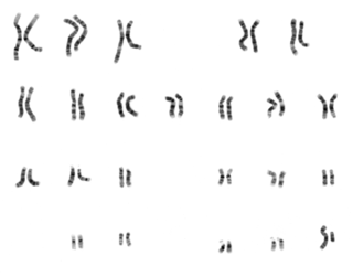 Caryotype humain