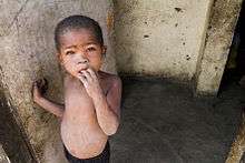 Enfant à Calitzdorp, Western Cape, Afrique du Sud.