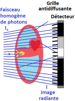 L'atténuation des photons lors d'une radiographie dépend des structures traversées. Les photons diffusés sont atténués par la grille antidiffusante avant d'atteindre le détecteur.