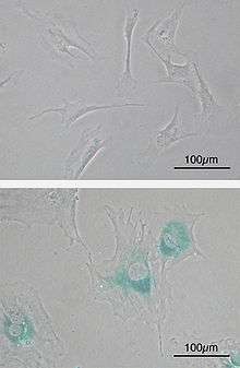 Cellules sénescentes en culture in vitro et réaction au SA-beta Gal