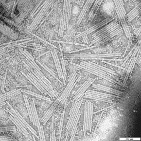 Microscopie électronique de particules du virus de la mosaïque du tabac.